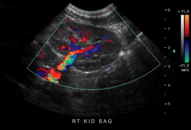 abdominal ultrasound case study