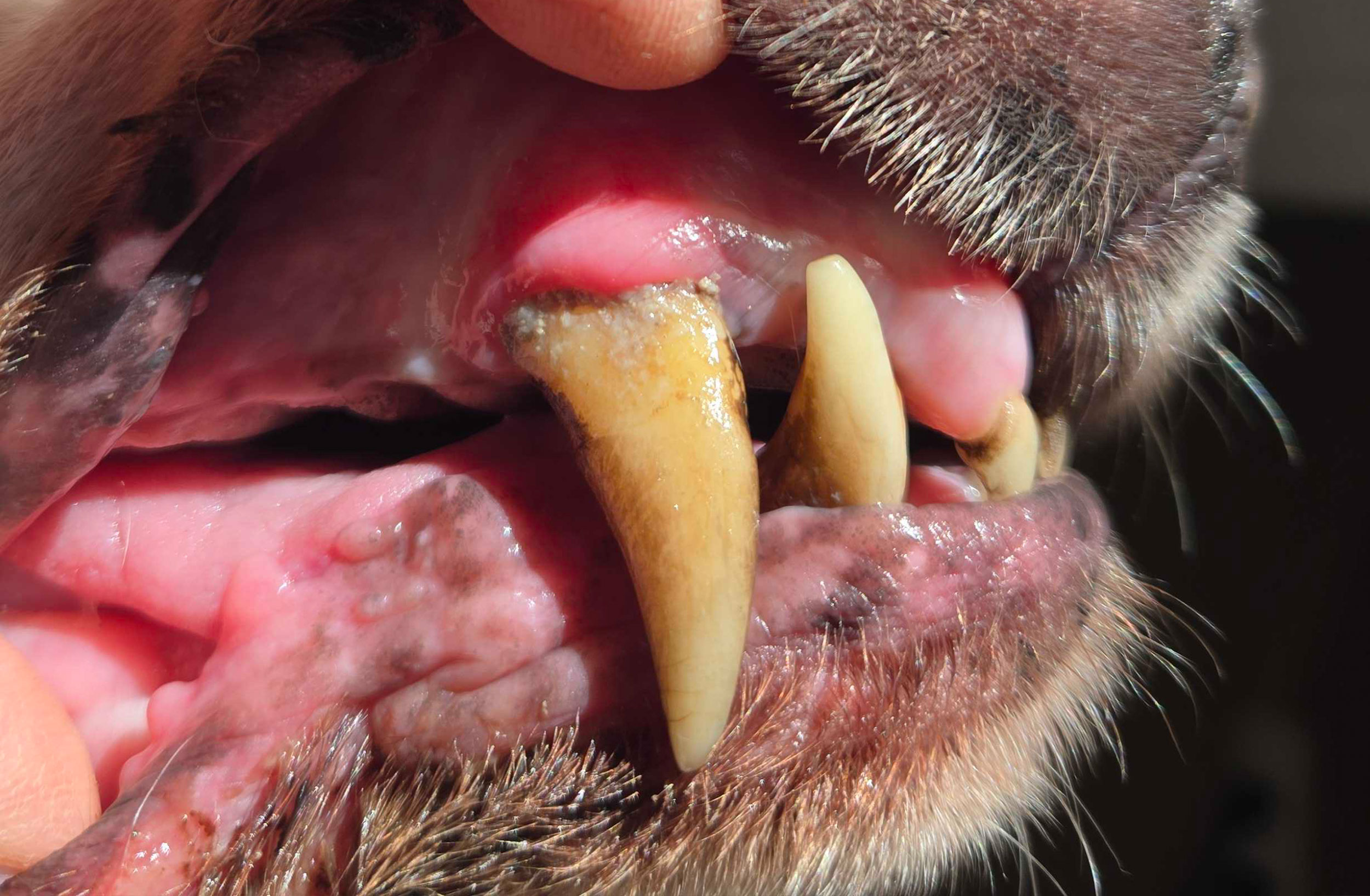 Stage 2 - Periodontal Disesase