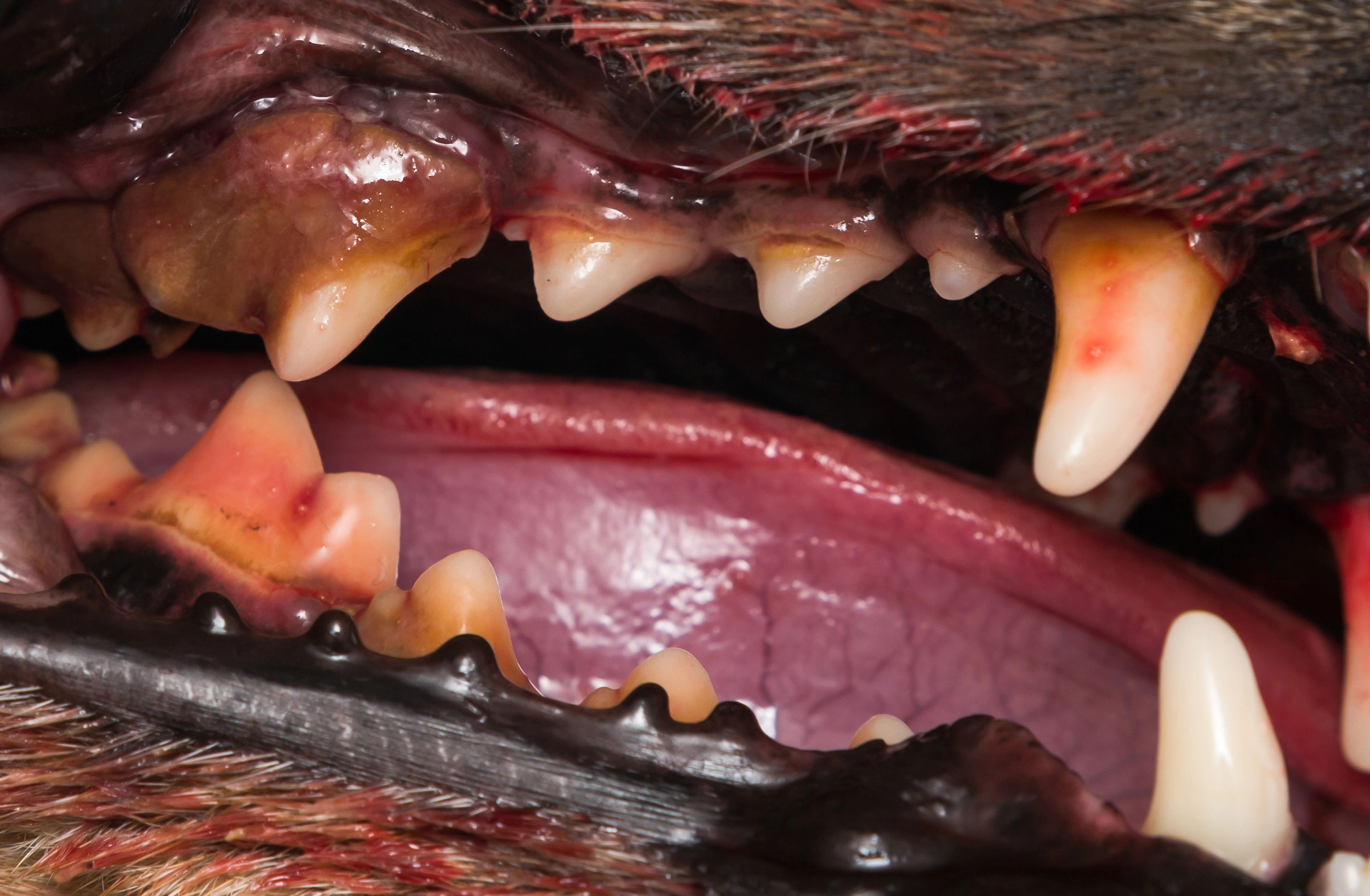 Stage 3 - Periodontal Disesase