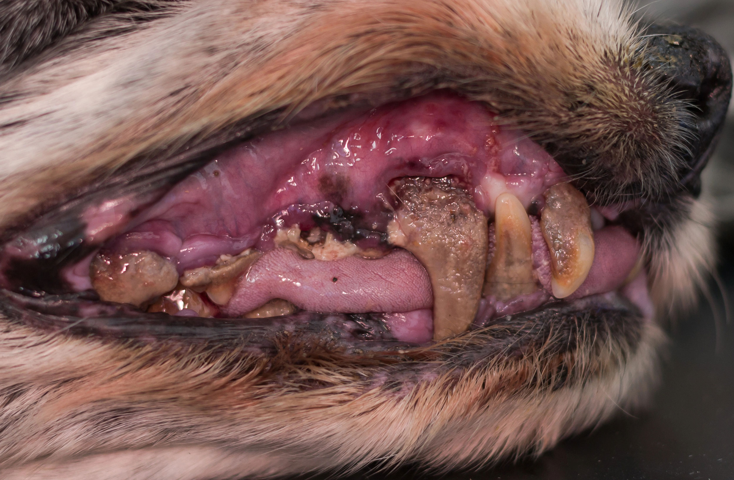Stage 4 - Periodontal Disesase