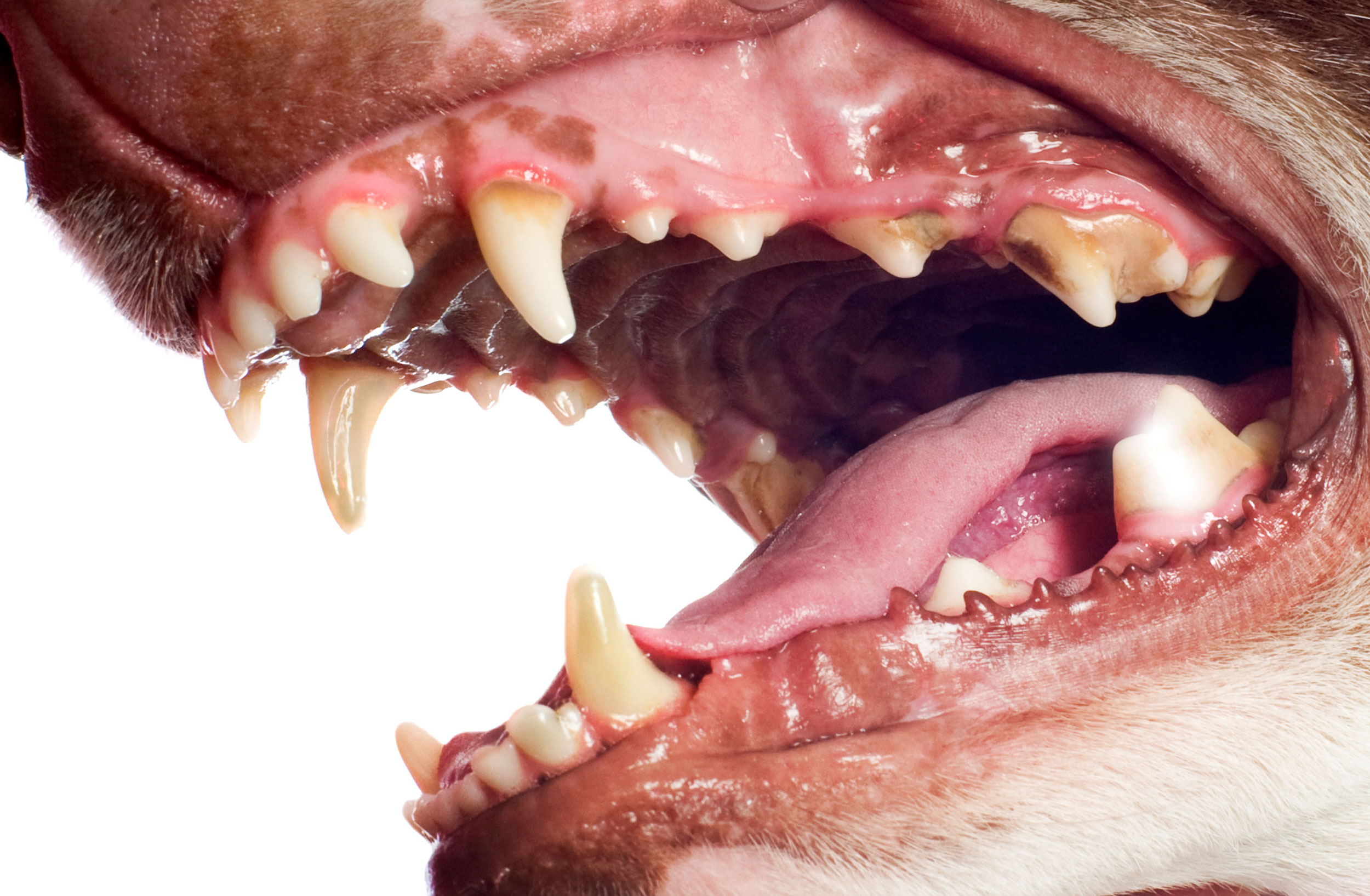 Stage 1 - Periodontal Disesase