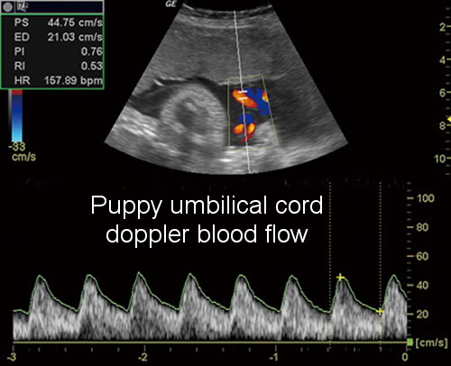 Ultrasound Example 1